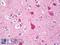 Endoplasmic Reticulum To Nucleus Signaling 1 antibody, LS-B8029, Lifespan Biosciences, Immunohistochemistry paraffin image 