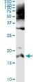 Pancreatic secretory trypsin inhibitor antibody, H00006690-M01, Novus Biologicals, Immunoprecipitation image 
