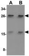 CD48 Molecule antibody, GTX17108, GeneTex, Western Blot image 