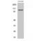 OCRL Inositol Polyphosphate-5-Phosphatase antibody, LS-C384998, Lifespan Biosciences, Western Blot image 