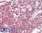 Kntc2 antibody, LS-B13683, Lifespan Biosciences, Immunohistochemistry paraffin image 