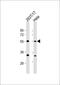 Aladin WD Repeat Nucleoporin antibody, 61-212, ProSci, Western Blot image 