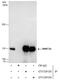 DNA Methyltransferase 3 Alpha antibody, GTX129125, GeneTex, Immunoprecipitation image 