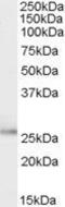 TPD52 Like 1 antibody, GTX88976, GeneTex, Western Blot image 
