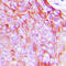 Insulin Receptor antibody, GTX55015, GeneTex, Immunohistochemistry paraffin image 
