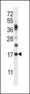 RNase K6 antibody, PA5-71818, Invitrogen Antibodies, Western Blot image 