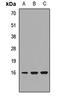 Proteasome Maturation Protein antibody, LS-C668426, Lifespan Biosciences, Western Blot image 