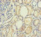 Phospholipase A2 Receptor 1 antibody, A57425-100, Epigentek, Immunohistochemistry paraffin image 
