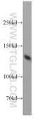 Bromodomain Containing 8 antibody, 10476-1-AP, Proteintech Group, Western Blot image 