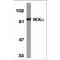 Inhibitor of nuclear factor kappa-B kinase subunit alpha antibody, TA305976, Origene, Western Blot image 