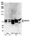 Zinc Finger Protein 276 antibody, A301-879A, Bethyl Labs, Western Blot image 