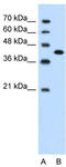Carcinoembryonic Antigen Related Cell Adhesion Molecule 6 antibody, TA346090, Origene, Western Blot image 