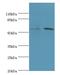 Ganglioside Induced Differentiation Associated Protein 2 antibody, A51285-100, Epigentek, Western Blot image 