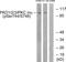 Protein Kinase D1 antibody, P30439, Boster Biological Technology, Western Blot image 