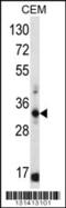 Free Fatty Acid Receptor 1 antibody, 56-402, ProSci, Western Blot image 