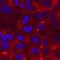 Integrin Subunit Alpha 8 antibody, MA5-24196, Invitrogen Antibodies, Immunocytochemistry image 