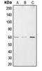 Cysteine And Serine Rich Nuclear Protein 2 antibody, LS-C353576, Lifespan Biosciences, Western Blot image 