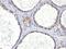 Androgen Receptor antibody, GTX34412, GeneTex, Immunohistochemistry paraffin image 