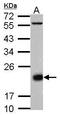 CD3d Molecule antibody, GTX105811, GeneTex, Western Blot image 