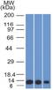 S100 Calcium Binding Protein A4 antibody, GTX35000, GeneTex, Western Blot image 