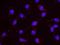 SDS3 Homolog, SIN3A Corepressor Complex Component antibody, NB100-93318, Novus Biologicals, Proximity Ligation Assay image 