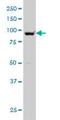 Helicase, Lymphoid Specific antibody, H00003070-M04, Novus Biologicals, Western Blot image 