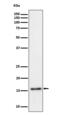 Trafficking Protein Particle Complex 2 antibody, M04968, Boster Biological Technology, Western Blot image 