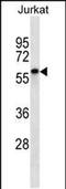 Ecto-NOX Disulfide-Thiol Exchanger 2 antibody, PA5-48481, Invitrogen Antibodies, Western Blot image 