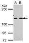BRCA1 Interacting Protein C-Terminal Helicase 1 antibody, PA5-29889, Invitrogen Antibodies, Western Blot image 