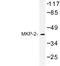 Dual Specificity Phosphatase 4 antibody, LS-C176928, Lifespan Biosciences, Western Blot image 