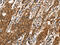 C-X-C Motif Chemokine Receptor 6 antibody, CSB-PA188638, Cusabio, Immunohistochemistry frozen image 