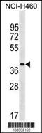 Zinc Finger Protein 488 antibody, 59-883, ProSci, Western Blot image 