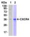 C-X-C Motif Chemokine Receptor 4 antibody, 1009, QED Bioscience, Western Blot image 