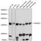 NODAL Modulator 1 antibody, GTX64667, GeneTex, Western Blot image 