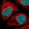 TMPO antibody, HPA008150, Atlas Antibodies, Immunofluorescence image 