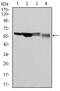 Glucose-6-Phosphate Dehydrogenase antibody, MA5-15918, Invitrogen Antibodies, Western Blot image 