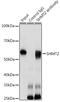 Serine Hydroxymethyltransferase 2 antibody, GTX64542, GeneTex, Immunoprecipitation image 