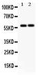 Scavenger Receptor Class B Member 1 antibody, PB9502, Boster Biological Technology, Western Blot image 