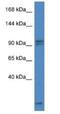 AP2 Associated Kinase 1 antibody, NBP1-79574, Novus Biologicals, Western Blot image 