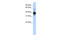 Nuclear Factor, Erythroid 2 antibody, 27-129, ProSci, Western Blot image 