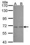 Cytochrome P450 Family 2 Subfamily J Member 2 antibody, PA5-29902, Invitrogen Antibodies, Western Blot image 