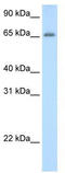 Adenosine Deaminase TRNA Specific 1 antibody, TA343781, Origene, Western Blot image 