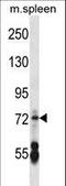 Cyclic Nucleotide Gated Channel Alpha 2 antibody, LS-B9623, Lifespan Biosciences, Western Blot image 