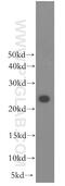 RAB2B, Member RAS Oncogene Family antibody, 11756-1-AP, Proteintech Group, Western Blot image 