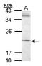 SEC61 Translocon Gamma Subunit antibody, LS-C185431, Lifespan Biosciences, Western Blot image 