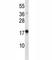 Thymic Stromal Lymphopoietin antibody, F44506-0.4ML, NSJ Bioreagents, Western Blot image 