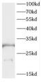 Carcinoembryonic Antigen Related Cell Adhesion Molecule 21 antibody, FNab01577, FineTest, Western Blot image 