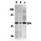 TNF Receptor Superfamily Member 10a antibody, MBS151351, MyBioSource, Western Blot image 