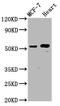 NOP53 Ribosome Biogenesis Factor antibody, CSB-PA885778LA01HU, Cusabio, Western Blot image 