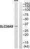 Solute Carrier Family 39 Member 9 antibody, TA315582, Origene, Western Blot image 